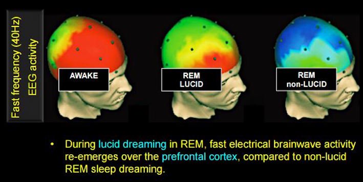 Lucid dreaming creates fast electrical brainwave activity