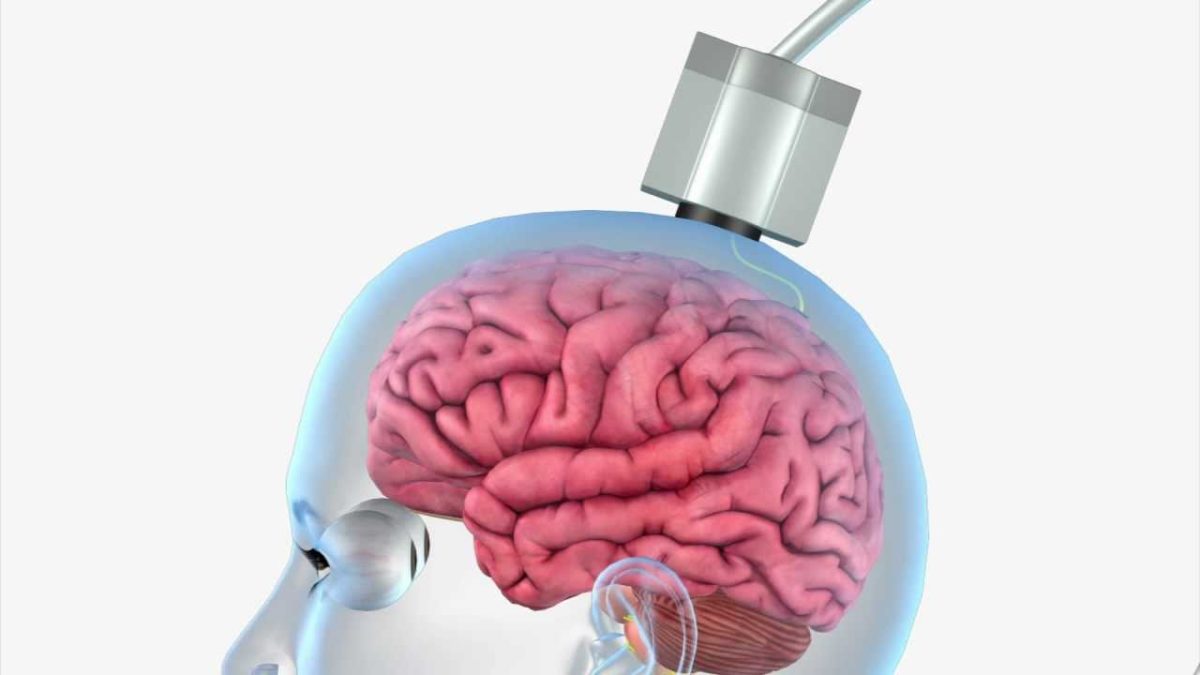 Watch: new technology lets paralyzed people text their thoughts