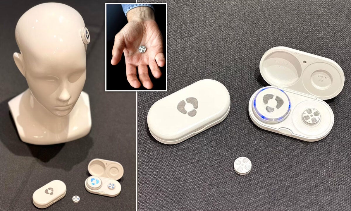 End of depression? The first brain implant to treat depression starts human trials