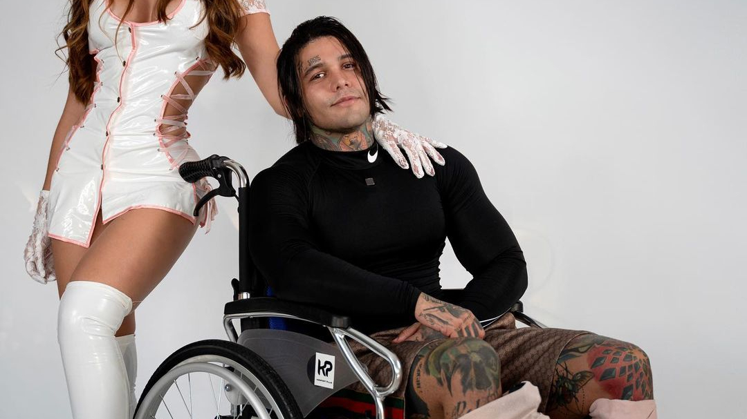 150,000 euros and inexplicable pain for an influencer’s silliest cosmetic operation