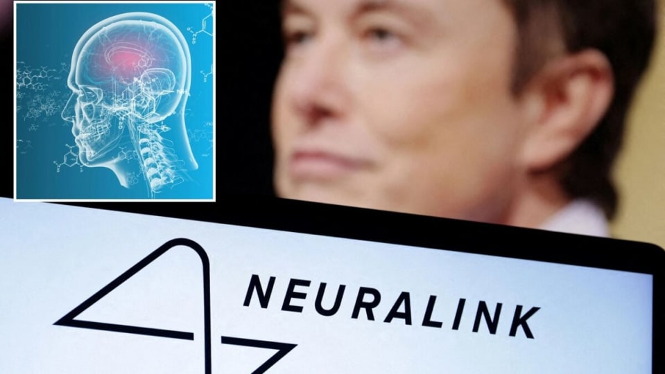 Elon Musk acaba de recibir el visto bueno para experimentar con nuestros cerebros