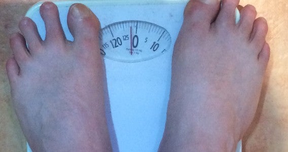 125 kg?
