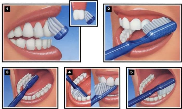Proper tooth brushing technique