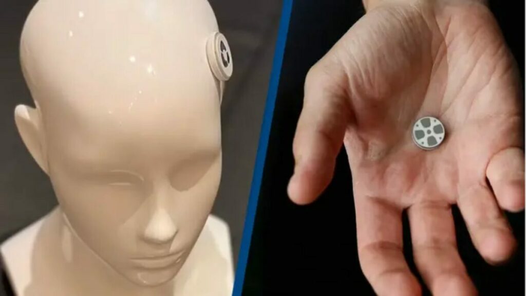 The first brain implant to treat depression starts human trials