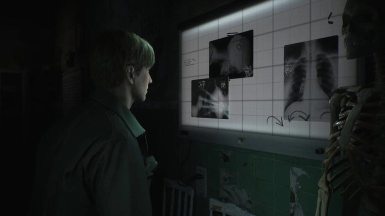 First Zelda, and now the remake of Silent Hill 2: A new round of leaks on social networks